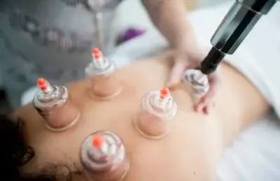 Photo Acupuncture